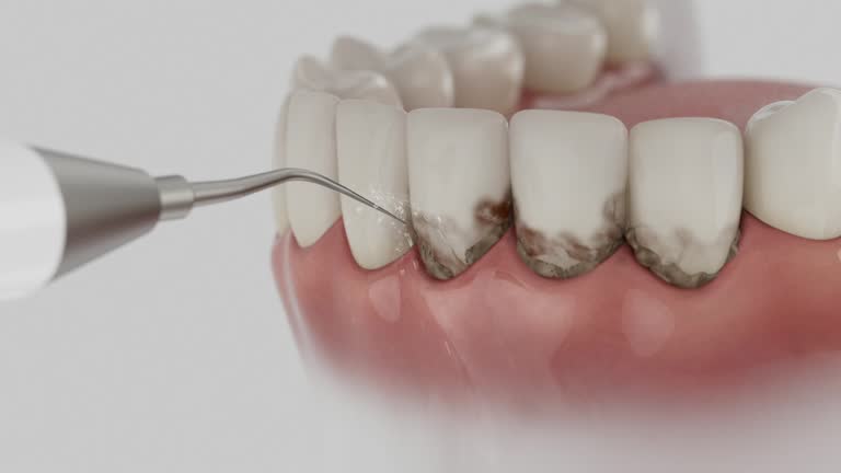 Trusted Dental Implants service in Dunkirk, MD - Dentist Open Now
